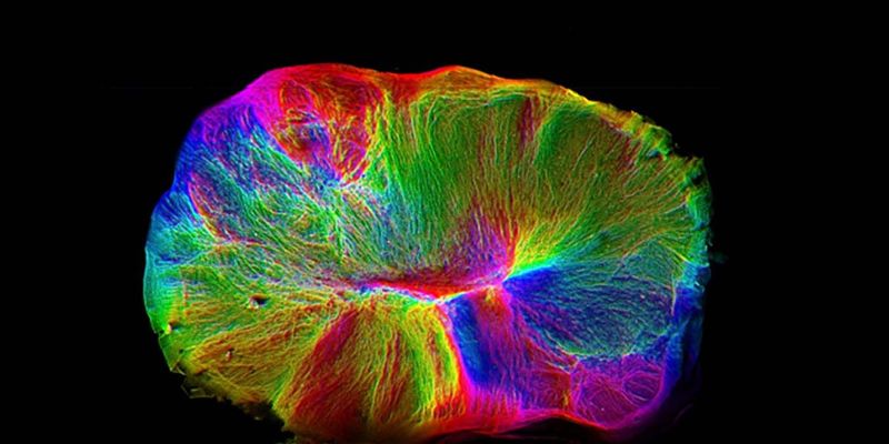 Ученым удалось вырастить "живой" мини-мозг: фото