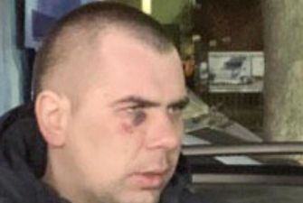 В Киеве пьяный мужчина на Ford сбил женщину с ребенком: водитель уснул в машине копов