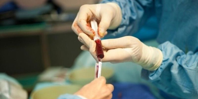 Минздрав планирует до конца года провести почти 130 трансплантаций