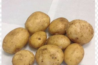 Какие блюда из картофеля считаются самыми вредными для здоровья