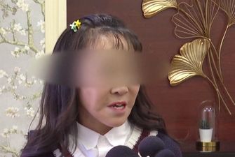 Пластичні хірурги зробили 15-річній китаянці нове обличчя
