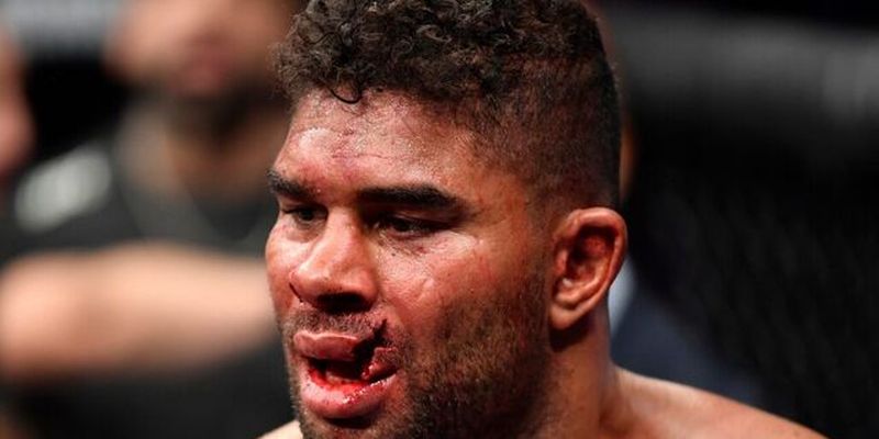 Боец UFC получил чудовищную травму на последней секунде боя: фото и видео 18+