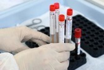 Для въезда в Украину отрицательный ПЦР-тест на коронавирус должны иметь все иностранцы – ГПСУ