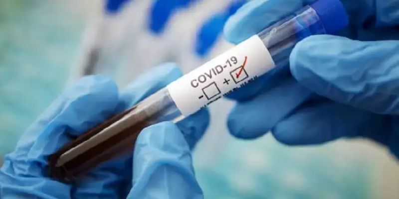 В Украине циркулируют 29 вариантов COVID-19, но все они переходят в категорию сезонных заболеваний