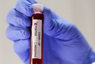 МОЗ включил препараты от малярии и ВИЧ в список для лечения коронавируса