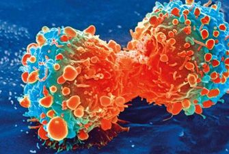 Вчені назвали головну причину виникнення раку