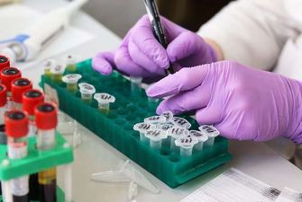 На Буковині за добу зафіксували 139 випадки коронавірусу