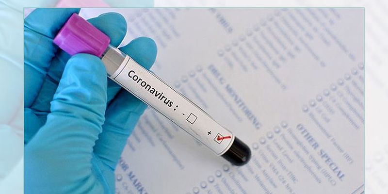 В Украине разработали собственный тест для выявления коронавируса