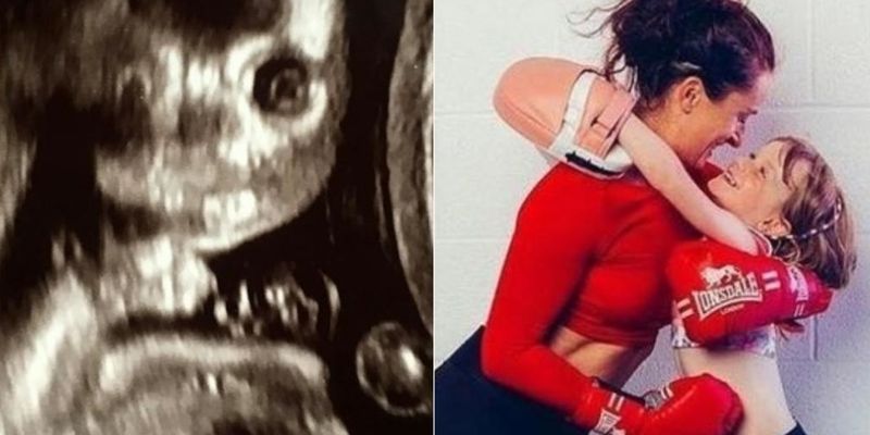 Не рождённый ребёнок смотрел прямо на неё: Снимок УЗИ вызвал шок у беременной девушки