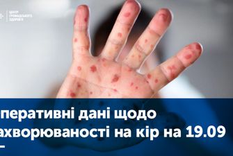 Втричі зросла кількість хворих на кір у Вінницькій області