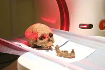 В Тернополе изучают череп возрастом три тысячи лет