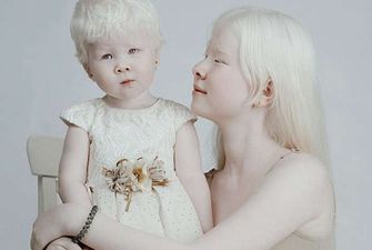 Сестры-альбиносы завораживают сеть своими фотографиями