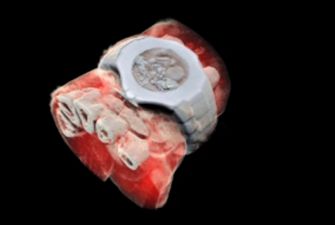 "Ошеломляет": сделаны первые трехмерные цветные рентгеновские снимки