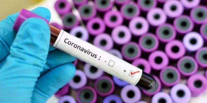 В Одесі не зареєстровані випадки захворювання коронавірусом 2019-nCoV