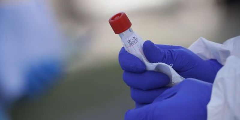Скандали через тестування на коронавірус: чому ПЛР-аналізи можуть давати хибний результат