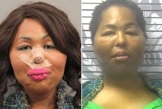 В США трансгендер ограбила банк, чтобы увеличить себе губы
