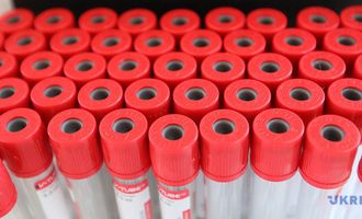 В Украине зафиксировали 296 новых случаев коронавируса