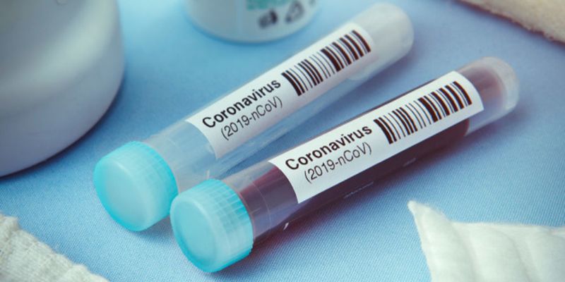 В украинской армии обнаружили 25 новых случаев коронавируса