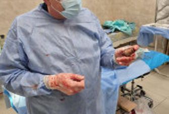 Оперували у присутності двох саперів: лікарі успішно видалили гранату ВОГ із тіла військовослужбовця