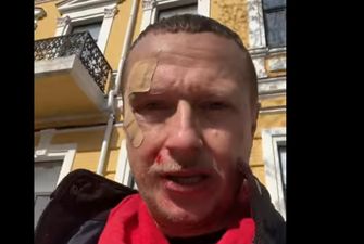 Журналиста и ведущего шоу "Телевидение Торонто" Майкла Щура избили в центре Киева