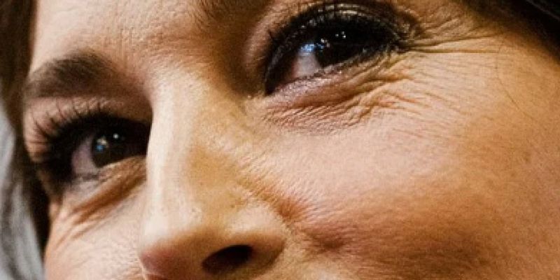 Бьюти-процедуры испортили кожу Монике Белуччи, Джиджи Хадид и Мелании Трамп: морщины и микротравмы