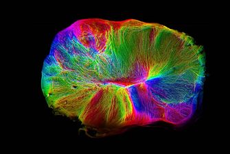 Ученым удалось вырастить "живой" мини-мозг: фото