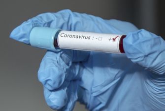 В Калифорнии зафиксировали второй случай заражения коронавирусом — WP