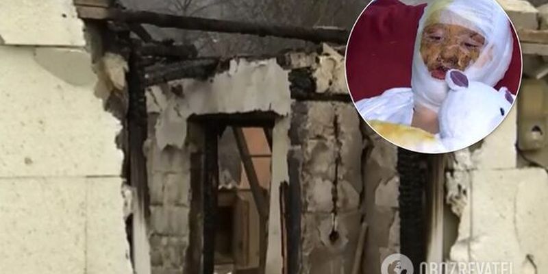 Отец поджег 16-летнюю дочь в Черновцах: выяснились детали зверской расправы. Фото и видео