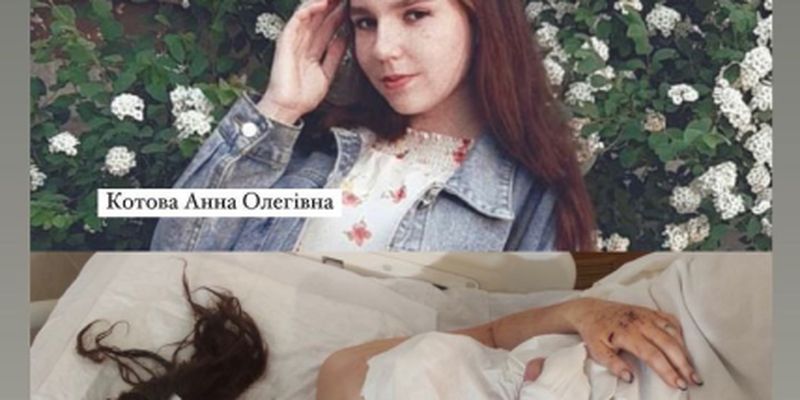 "Я теряю время": 19-летняя девушка, оставшаяся без глаза от удара РФ по Днепру, просит о помощи