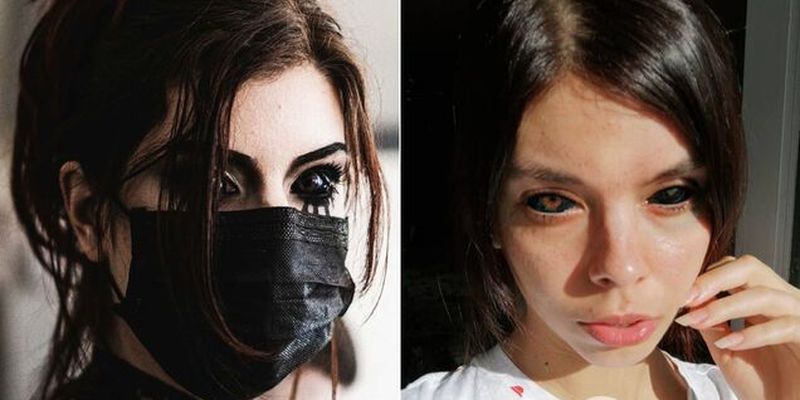 Татуировки на глазах: польская модель ослепла после неудачной процедуры