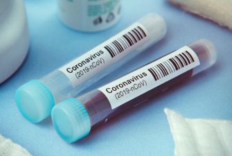 В Украине зафиксировали 420 новых случаев коронавируса