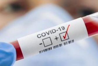 Результат за 5 минут: в США изобрели революционные тесты на коронавирус