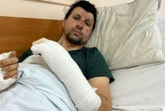 15% опіків тіла: у Львові 37-річний чоловік постраждав від вибуху акумулятора в квартирі