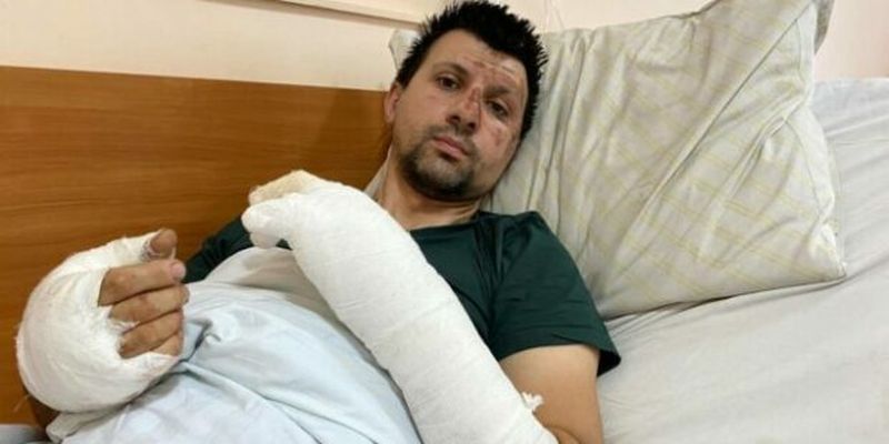 15% ожогов тела: во Львове 37-летний мужчина пострадал от взрыва аккумулятора в квартире