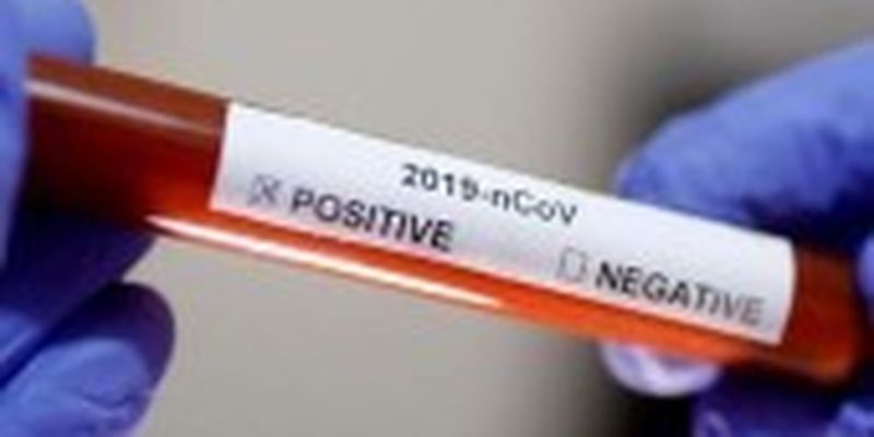 На Буковині виявили 22 нові випадки коронавірусу за добу
