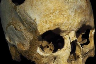 Дело рук мистиков или обычных врачей. Что не так с 2300-летним черепом, который нашли в Турции