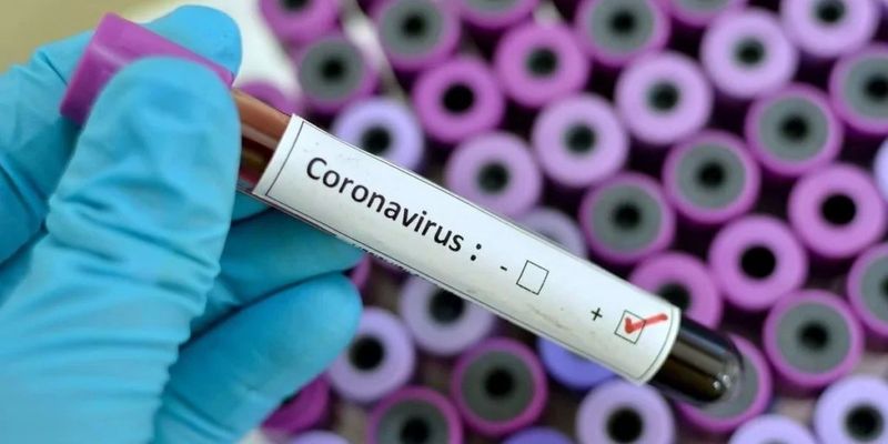Эксперт: здоровые люди могут быть переносчиками коронавируса