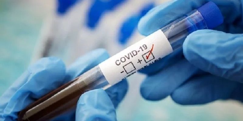 В ВОЗ узнали, когда именно появился коронавирус, вызвавший пандемию