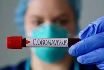 В Киеве за сутки - 497 случаев COVID-19, десять больных умерли