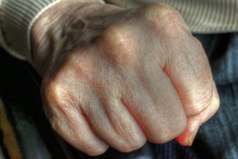 Пенсіонерка до смерті побила 91-річного чоловіка через ревнощі