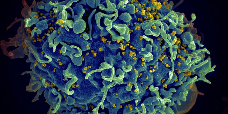 Виріжуть ВІЛ просто з клітин: учені тестують редактор генів CRISPR для боротьби з хворобою