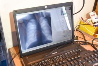 Туберкульоз щороку вбиває 4 тисячі українців