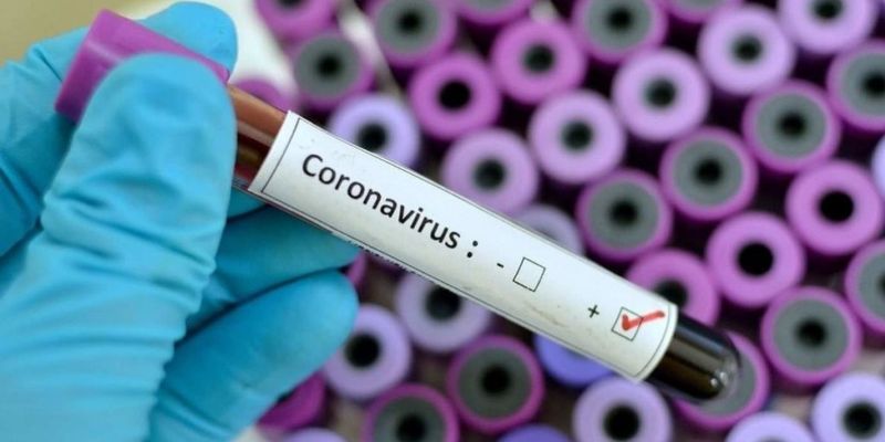 Минздрав: Инфицирование коронавирусом выявлено в 29 странах