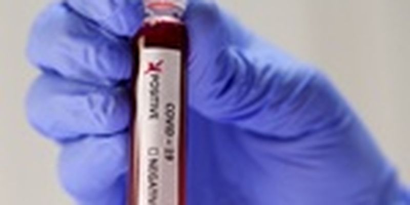 МОЗ включил препараты от малярии и ВИЧ в список для лечения коронавируса
