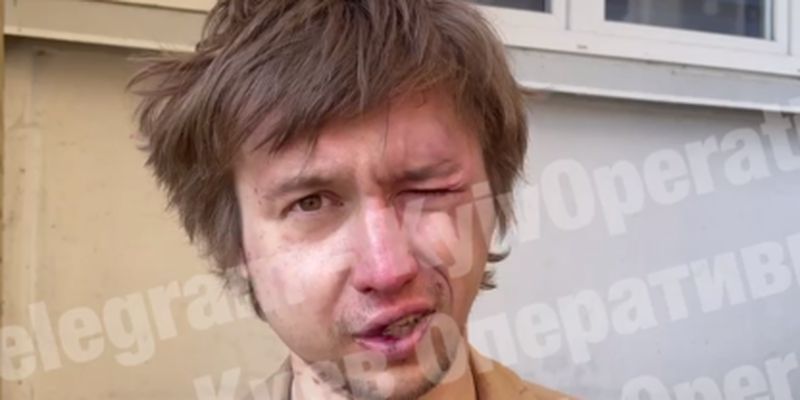 В Киеве парень "поймал белочку" и открыл стрельбу по полицейским: фото и видео