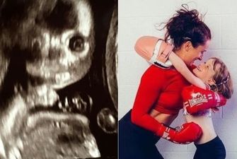 Не рождённый ребёнок смотрел прямо на неё: Снимок УЗИ вызвал шок у беременной девушки