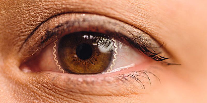 Решение глобальной проблемы: созданы контактные линзы для диагностики и лечения глаукомы