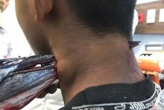 В Індонезії риба проштрикнула шию 16-річному хлопцю, той вижив