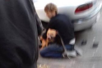 Разорвала пятку до кости: в Киеве собака напала на маленького ребенка. Фото 18+