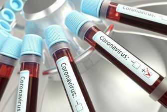 У Словаччині – перша смерть від коронавірусу